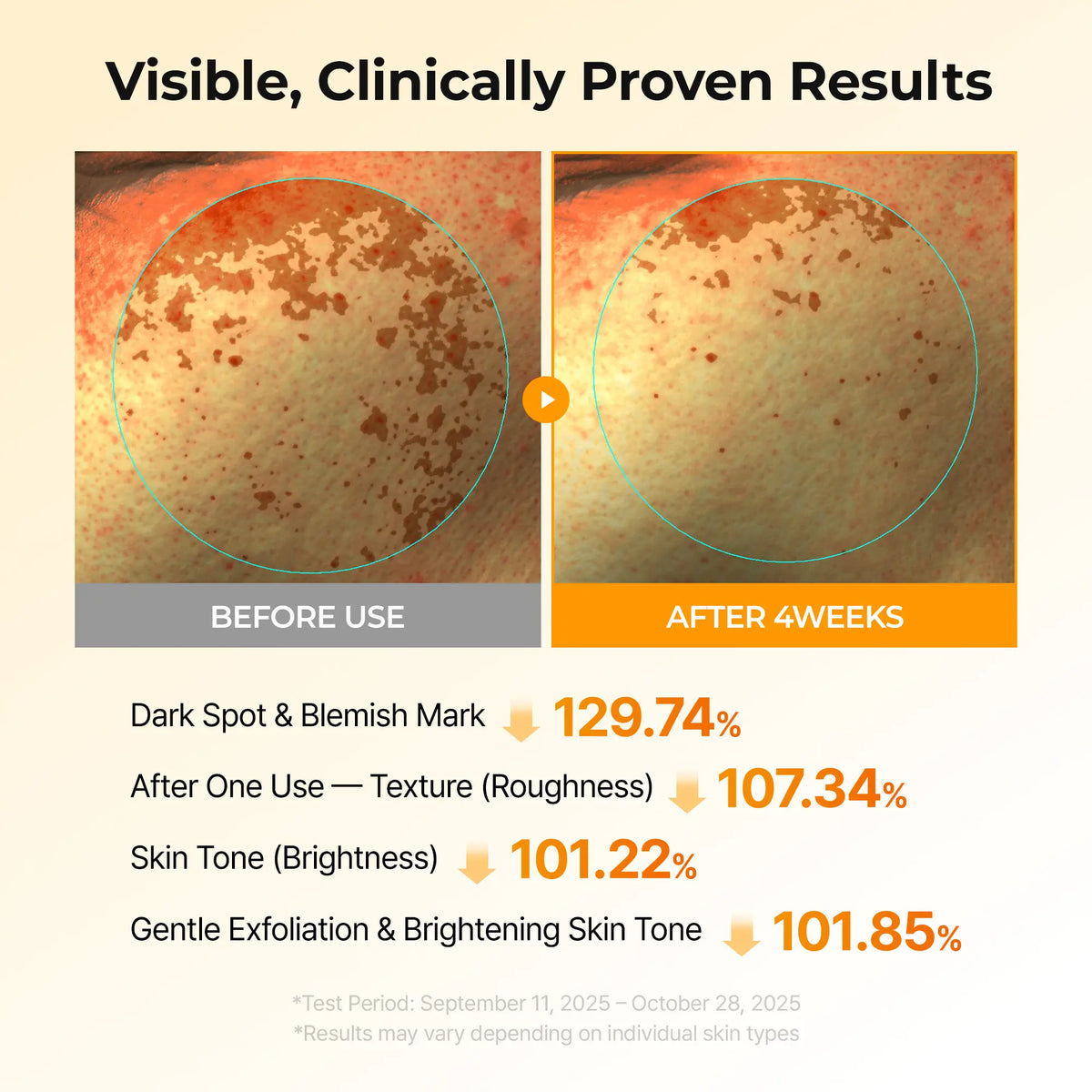 Kojic Acid Turmeric TX Toner Pad 70pads, Dark Spot & Pigmentation Care for Uneven Skin Tone