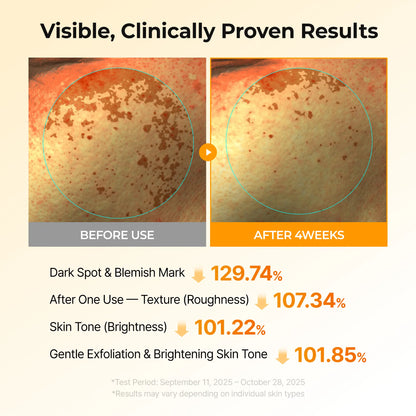 Kojic Acid Turmeric TX Toner Pad 70pads, Dark Spot & Pigmentation Care for Uneven Skin Tone