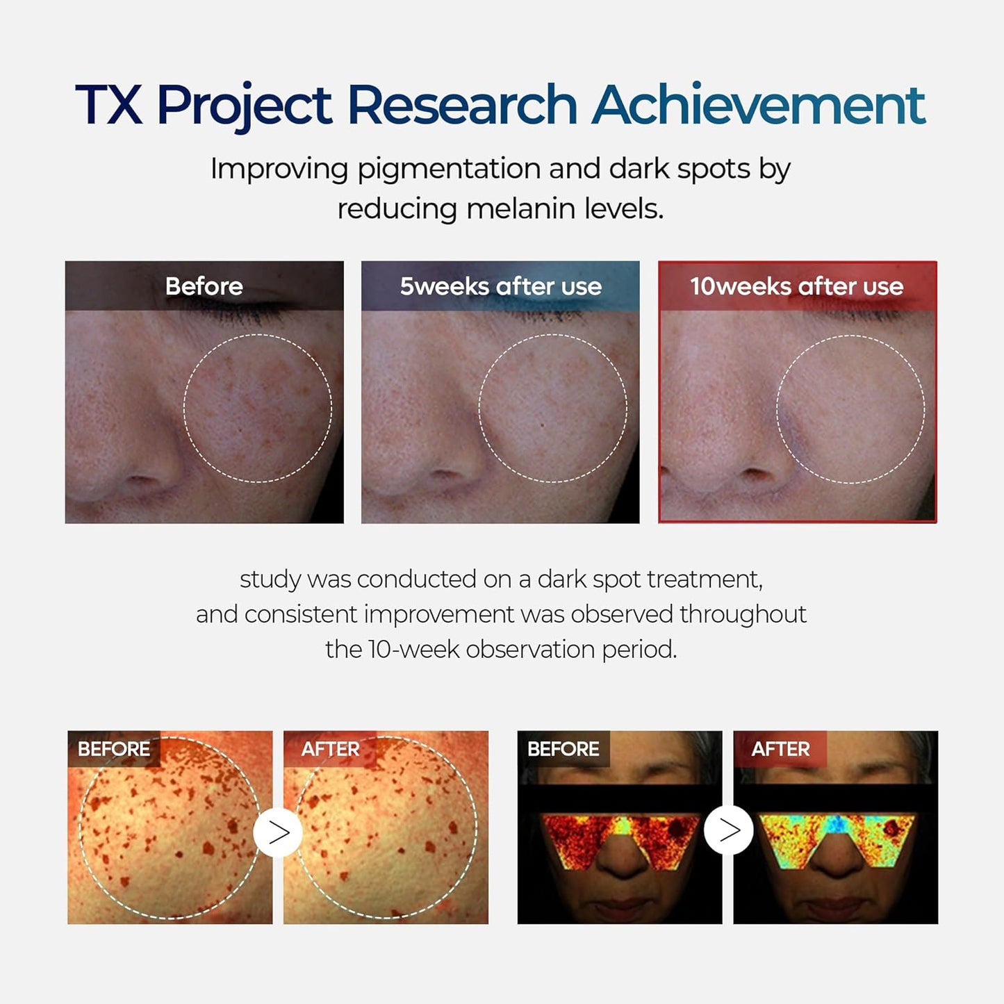 Korean Tranexamic Acid CREAM