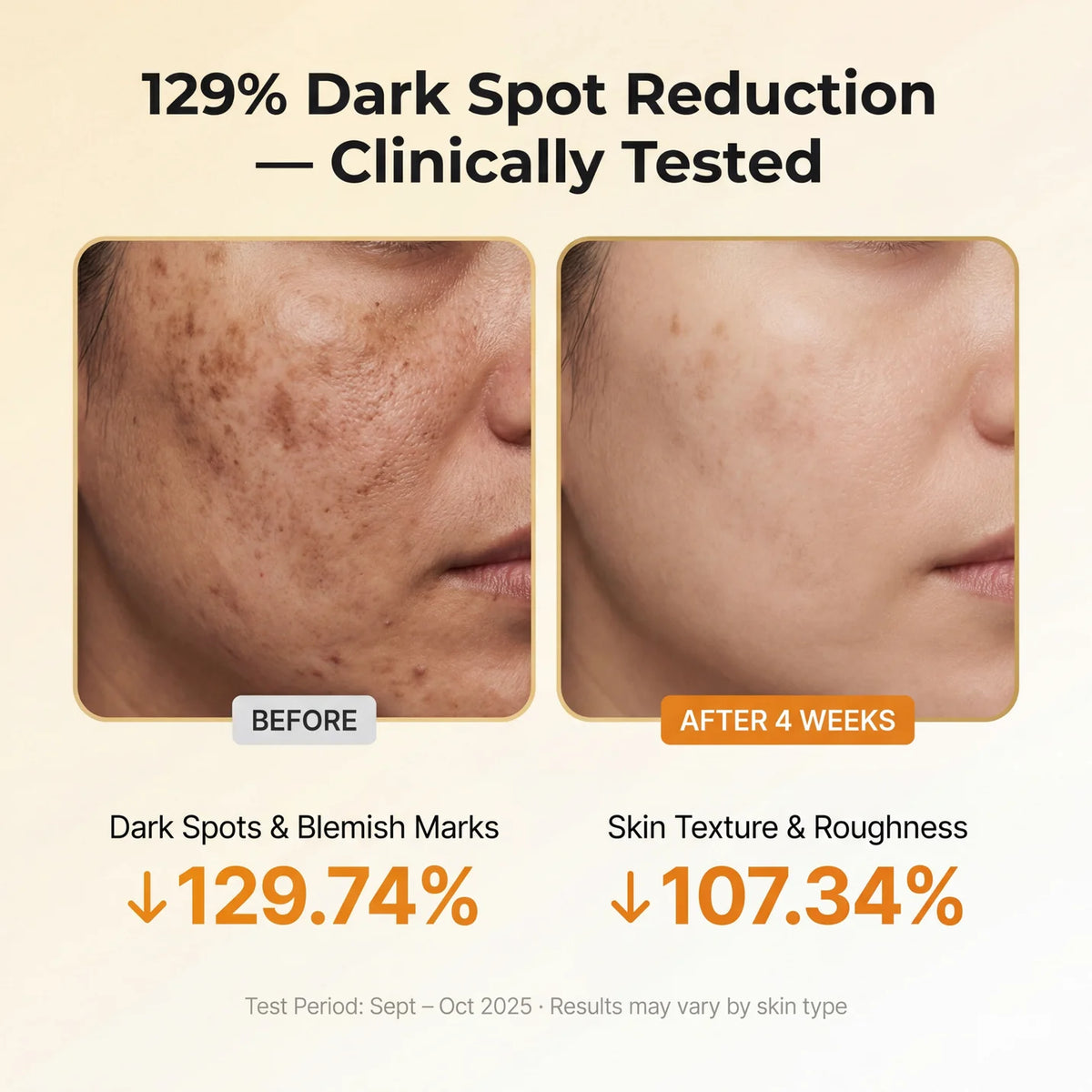 Kojic Acid Turmeric TX Toner Pad 70pads, Dark Spot & Pigmentation Care for Uneven Skin Tone