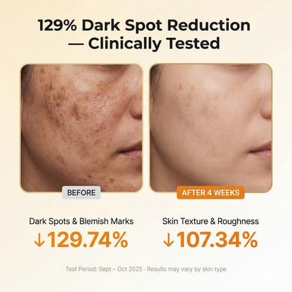 Kojic Acid Turmeric TX Toner Pad 70pads, Dark Spot & Pigmentation Care for Uneven Skin Tone